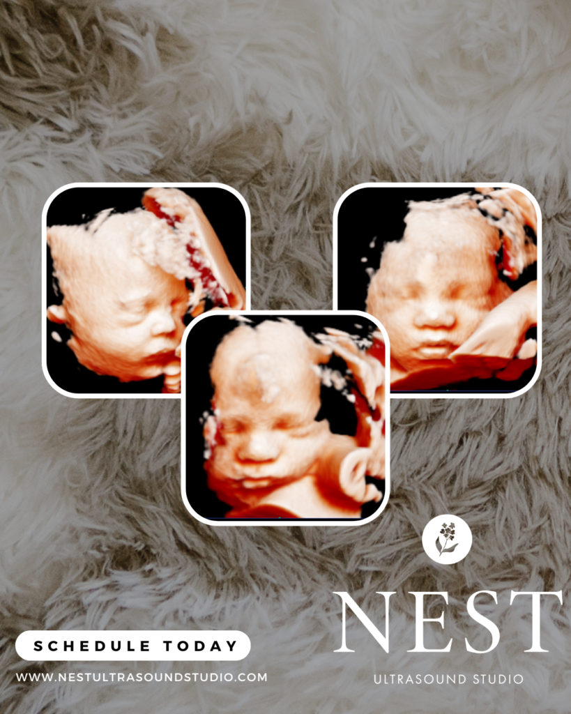 3D/4D/HD elective ultrasound image, Nest Ultrasound Studio