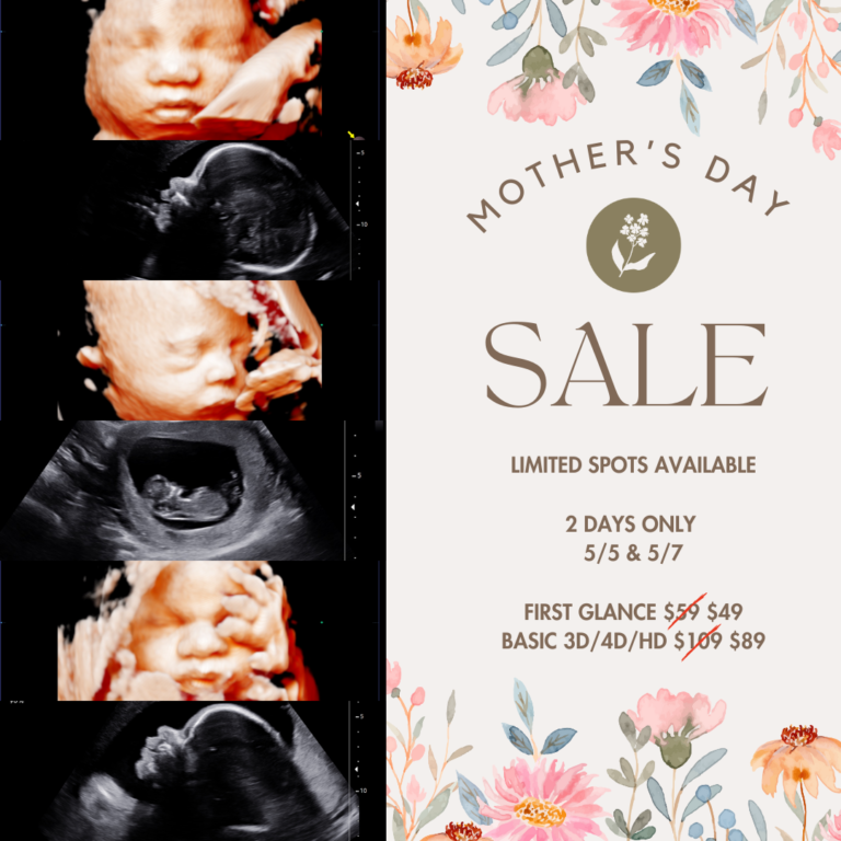 Celebrate Mother’s Day with Nest Ultrasound Studio in Trinity, FL