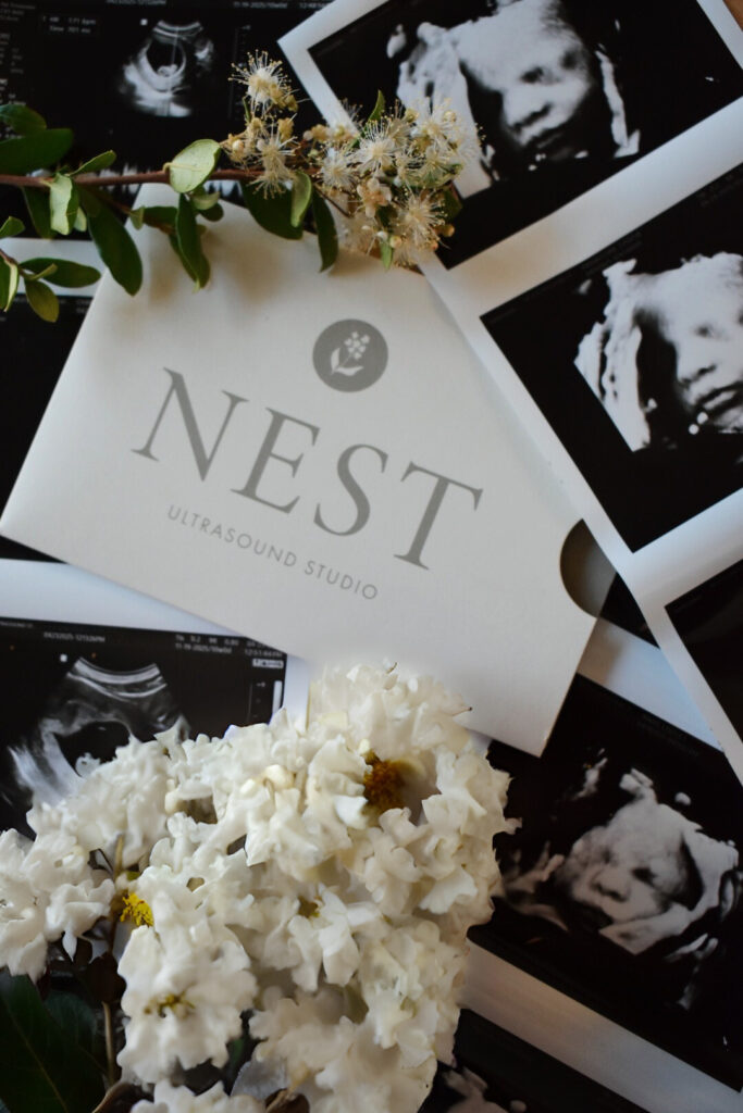 Black and white ultrasound photos arranged around a Nest Ultrasound Studio brochure with white flowers
